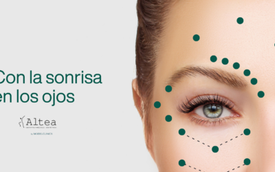 Me gusta como sonríen tus ojos